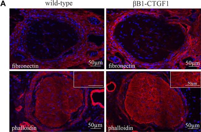 Rabbit IgG (H+L) Highly Cross-Adsorbed Secondary Antibody in Immunohistochemistry (IHC)