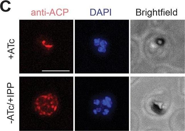 Rabbit IgG (H+L) Highly Cross-Adsorbed Secondary Antibody in Immunocytochemistry (ICC/IF)