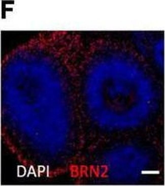 Rabbit IgG (H+L) Highly Cross-Adsorbed Secondary Antibody in Immunohistochemistry (IHC)