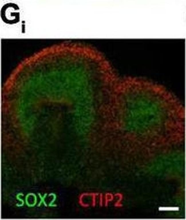 Rabbit IgG (H+L) Highly Cross-Adsorbed Secondary Antibody in Immunocytochemistry (ICC/IF)