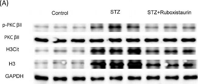 Rat IgG (H+L) Cross-Adsorbed Secondary Antibody in Western Blot (WB)