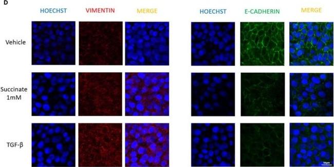 Rabbit IgG (H+L) Cross-Adsorbed Secondary Antibody in Immunocytochemistry (ICC/IF)