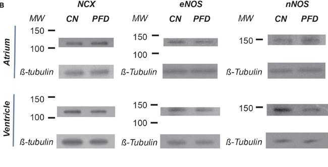 Mouse IgG (H+L) Cross-Adsorbed Secondary Antibody in Western Blot (WB)