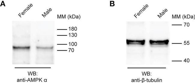 Rabbit IgG (H+L) Cross-Adsorbed Secondary Antibody in Western Blot (WB)