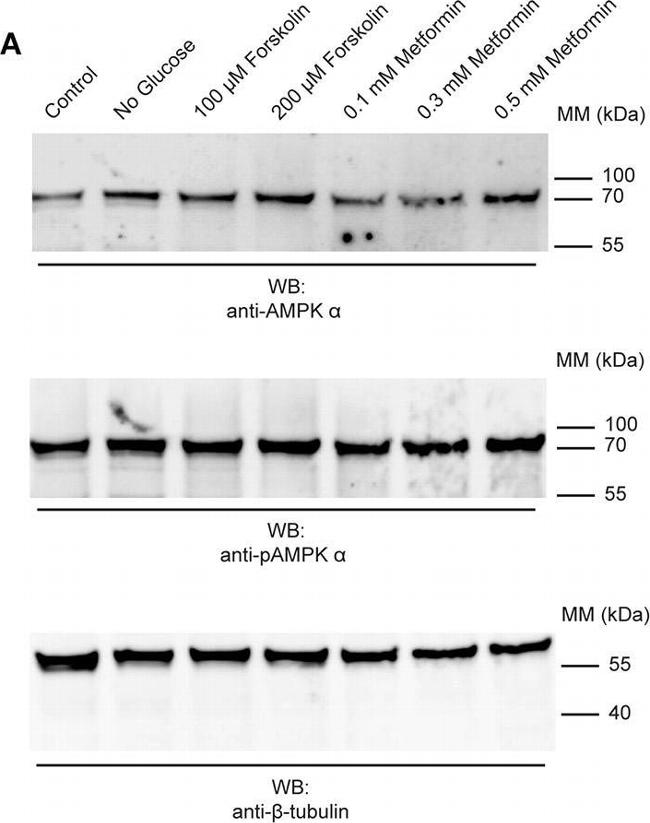 Rabbit IgG (H+L) Cross-Adsorbed Secondary Antibody in Western Blot (WB)