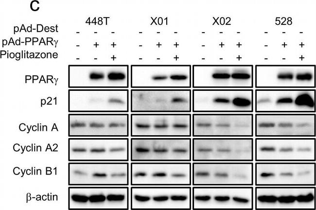 Rabbit IgG (H+L) Cross-Adsorbed Secondary Antibody in Western Blot (WB)