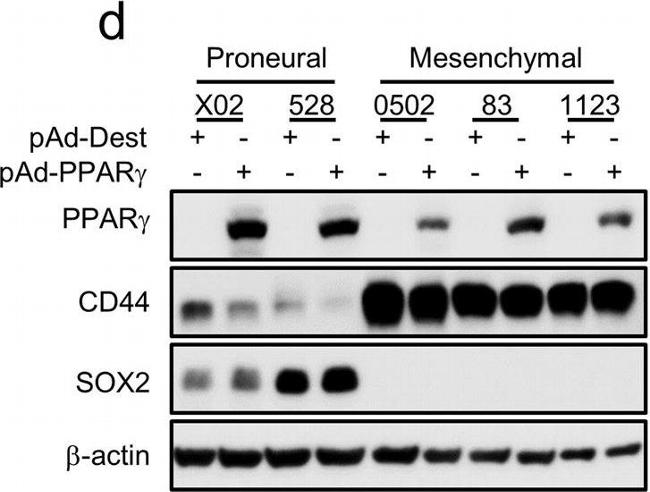 Rabbit IgG (H+L) Cross-Adsorbed Secondary Antibody in Western Blot (WB)