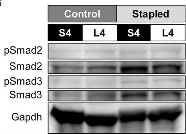 Rabbit IgG (H+L) Cross-Adsorbed Secondary Antibody in Western Blot (WB)