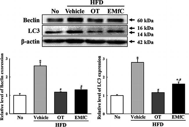 Rabbit IgG (H+L) Cross-Adsorbed Secondary Antibody in Western Blot (WB)