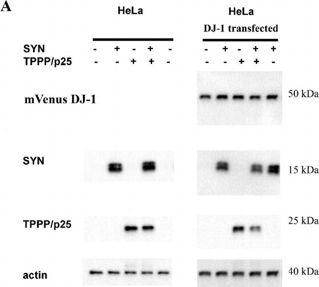 Rabbit IgG (H+L) Poly-HRP Secondary Antibody in Western Blot (WB)