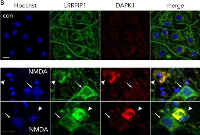 Rabbit IgG (H+L) Secondary Antibody in Immunocytochemistry (ICC/IF)