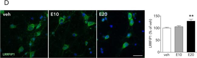 Rabbit IgG (H+L) Secondary Antibody in Immunocytochemistry (ICC/IF)