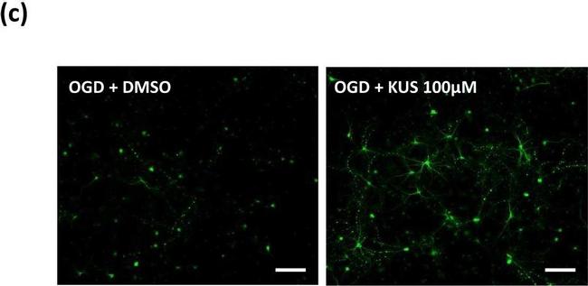 Mouse IgG (H+L) Secondary Antibody in Immunocytochemistry (ICC/IF)