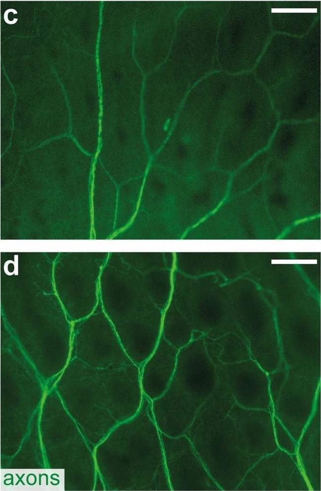 Mouse IgG (H+L) Secondary Antibody in Immunohistochemistry (IHC)