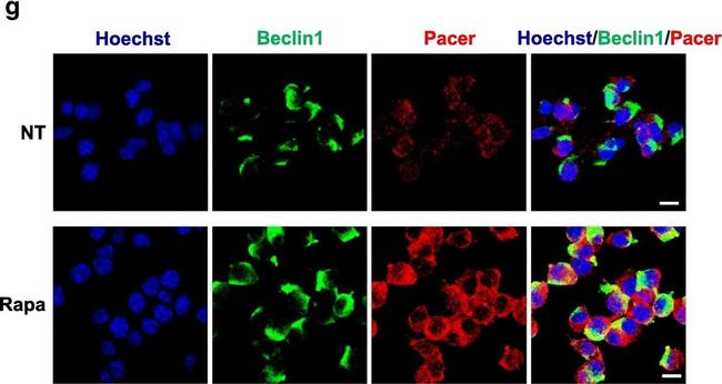 Rabbit IgG (Heavy chain) Secondary Antibody in Immunocytochemistry (ICC/IF)