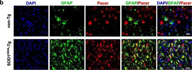 Rabbit IgG (Heavy chain) Secondary Antibody in Immunocytochemistry (ICC/IF)