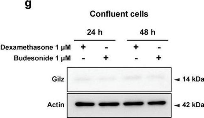 Rat IgG (H+L) Secondary Antibody in Western Blot (WB)