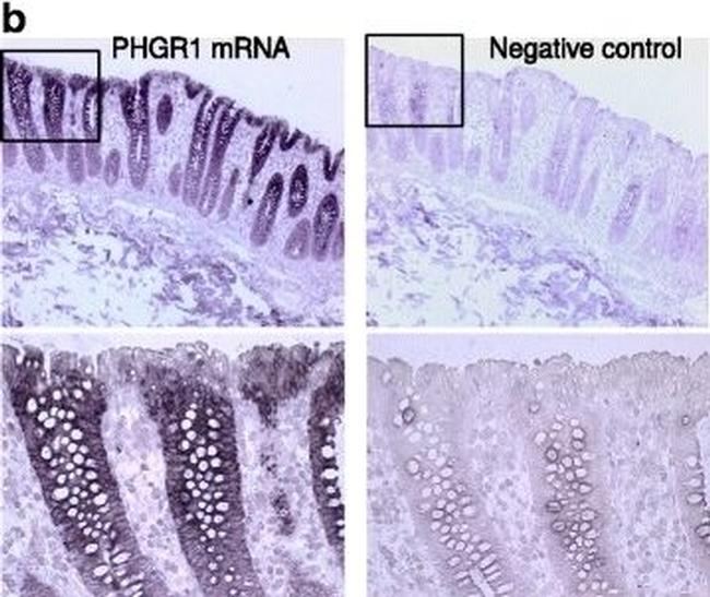 Rabbit IgG Isotype Control in Immunohistochemistry (Paraffin) (IHC (P))