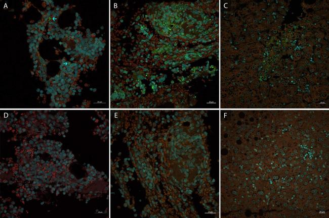 Mouse IgG (H+L) Highly Cross-Adsorbed Secondary Antibody in Immunocytochemistry (ICC/IF)