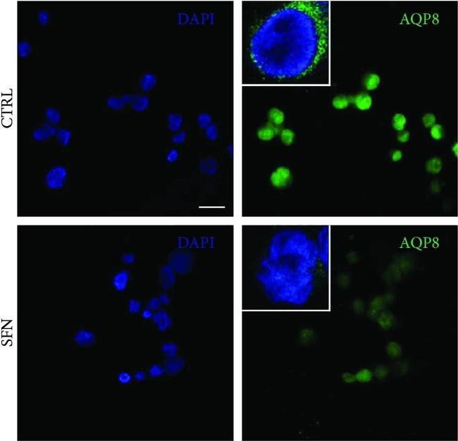 Mouse IgG (H+L) Highly Cross-Adsorbed Secondary Antibody in Immunocytochemistry (ICC/IF)