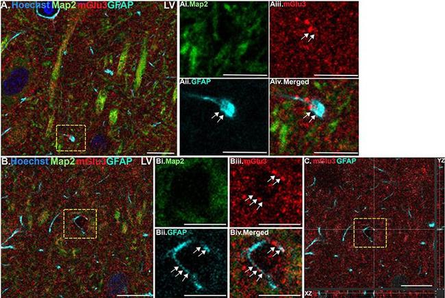 Mouse IgG (H+L) Highly Cross-Adsorbed Secondary Antibody in Immunohistochemistry (IHC)