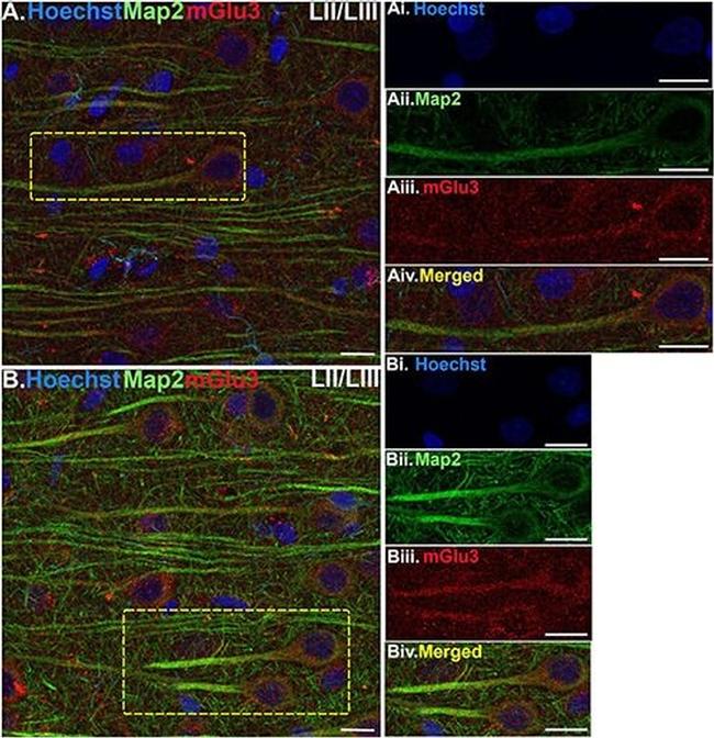 Mouse IgG (H+L) Highly Cross-Adsorbed Secondary Antibody in Immunohistochemistry (IHC)