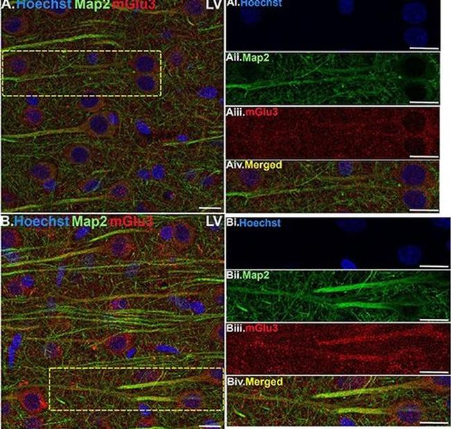 Mouse IgG (H+L) Highly Cross-Adsorbed Secondary Antibody in Immunohistochemistry (IHC)