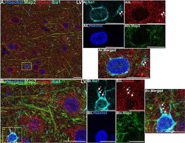 Mouse IgG (H+L) Highly Cross-Adsorbed Secondary Antibody in Immunohistochemistry (IHC)