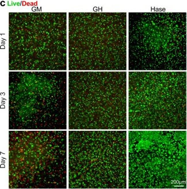 Mouse IgG (H+L) Highly Cross-Adsorbed Secondary Antibody in Immunocytochemistry (ICC/IF)