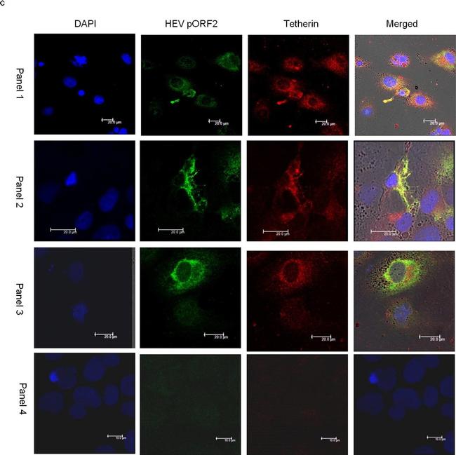 Mouse IgG (H+L) Highly Cross-Adsorbed Secondary Antibody in Immunocytochemistry (ICC/IF)