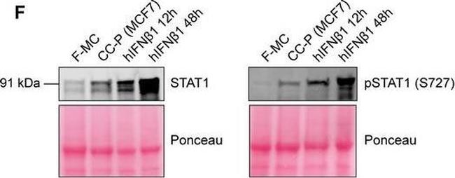 Rabbit IgG (H+L) Highly Cross-Adsorbed Secondary Antibody in Western Blot (WB)