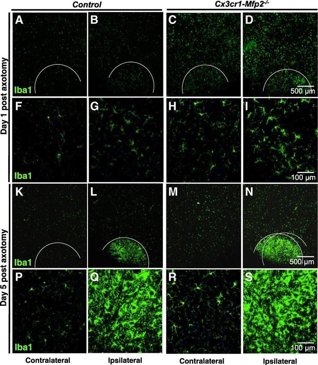 Rabbit IgG (H+L) Highly Cross-Adsorbed Secondary Antibody in Immunohistochemistry (Paraffin) (IHC (P))