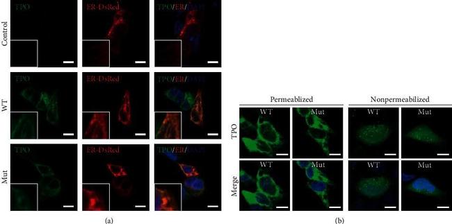 Rabbit IgG (H+L) Highly Cross-Adsorbed Secondary Antibody in Immunocytochemistry (ICC/IF)