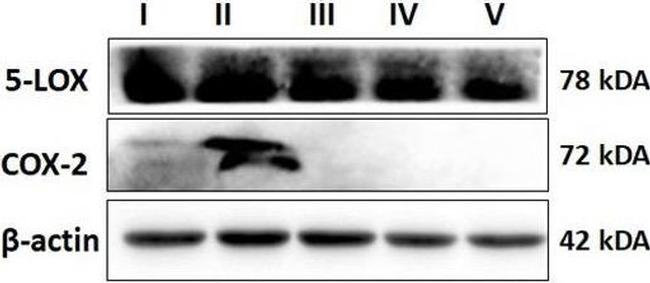 Mouse IgG (H+L) Secondary Antibody in Western Blot (WB)