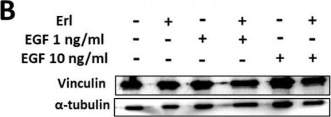 Mouse IgG (H+L) Secondary Antibody in Western Blot (WB)