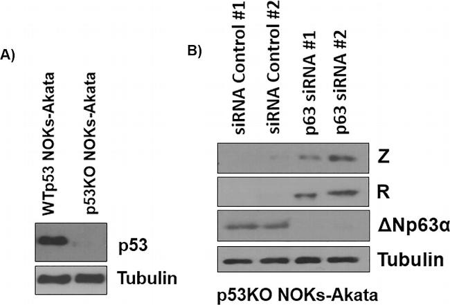 Mouse IgG (H+L) Secondary Antibody in Western Blot (WB)