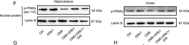 Rabbit IgG (H+L) Secondary Antibody in Western Blot (WB)