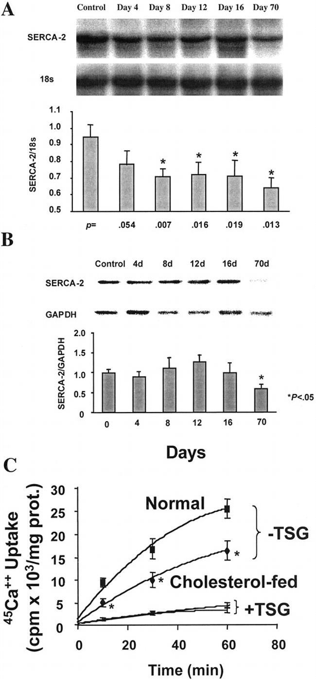 SERCA2 ATPase Antibody in Western Blot (WB)