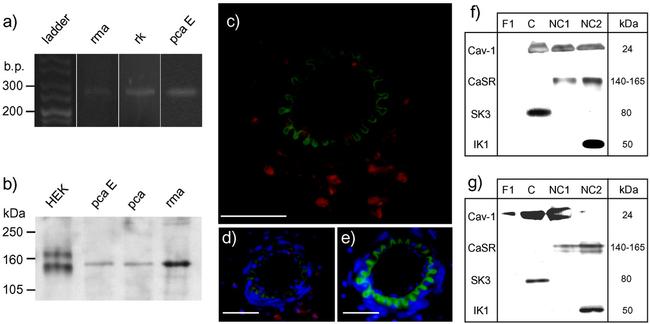 Calcium Sensing Receptor Antibody in Western Blot, Immunohistochemistry (WB, IHC)