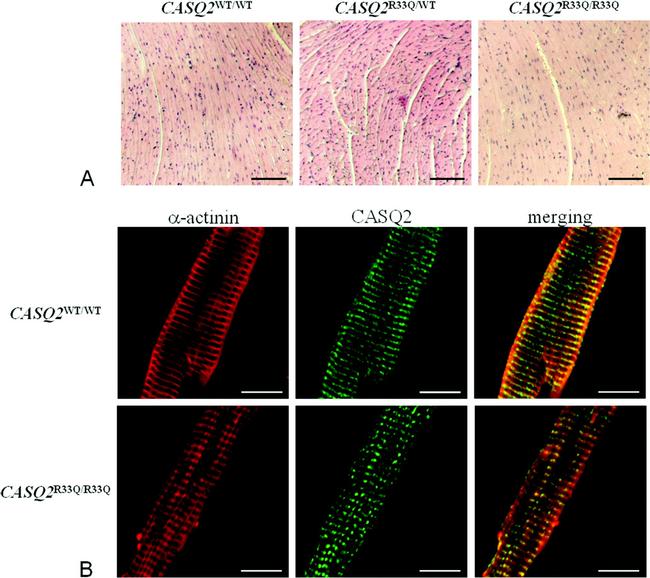 Calsequestrin Antibody in Immunocytochemistry (ICC/IF)