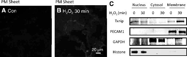 TXNIP Antibody in Western Blot, Immunocytochemistry (WB, ICC/IF)