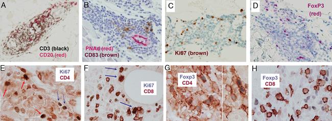 FOXP3 Antibody in Immunohistochemistry (Paraffin) (IHC (P))