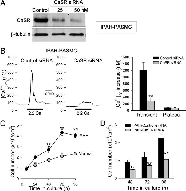 Calcium Sensing Receptor Antibody in Western Blot (WB)