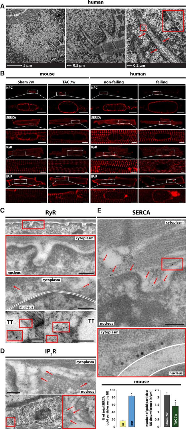 SERCA2 ATPase Antibody in Immunocytochemistry (ICC/IF)