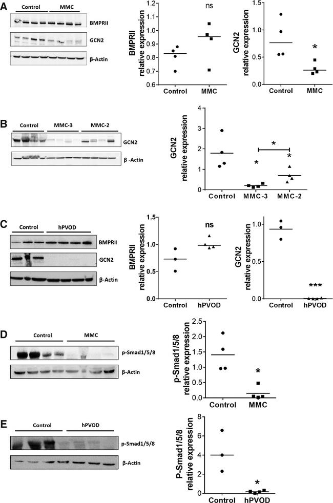 BMPR2 Antibody in Western Blot (WB)