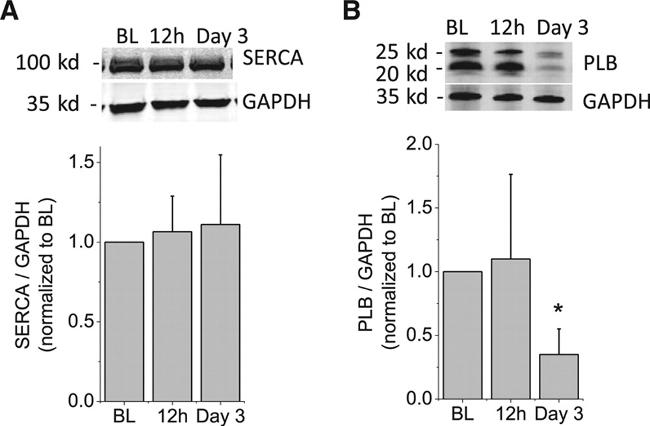 Phospholamban Antibody in Western Blot (WB)