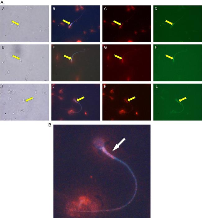 TYRO3 Antibody in Immunocytochemistry (ICC/IF)