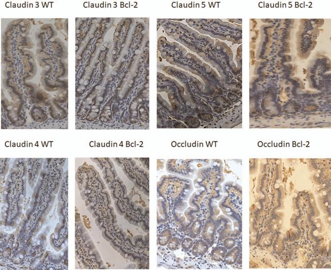 Claudin 4 Antibody in Immunohistochemistry (IHC)