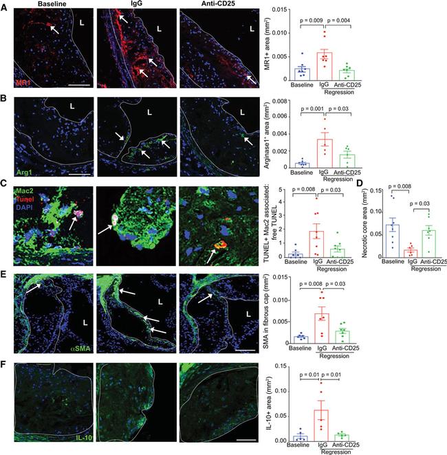 Arginase 1 Antibody in Immunohistochemistry (IHC)