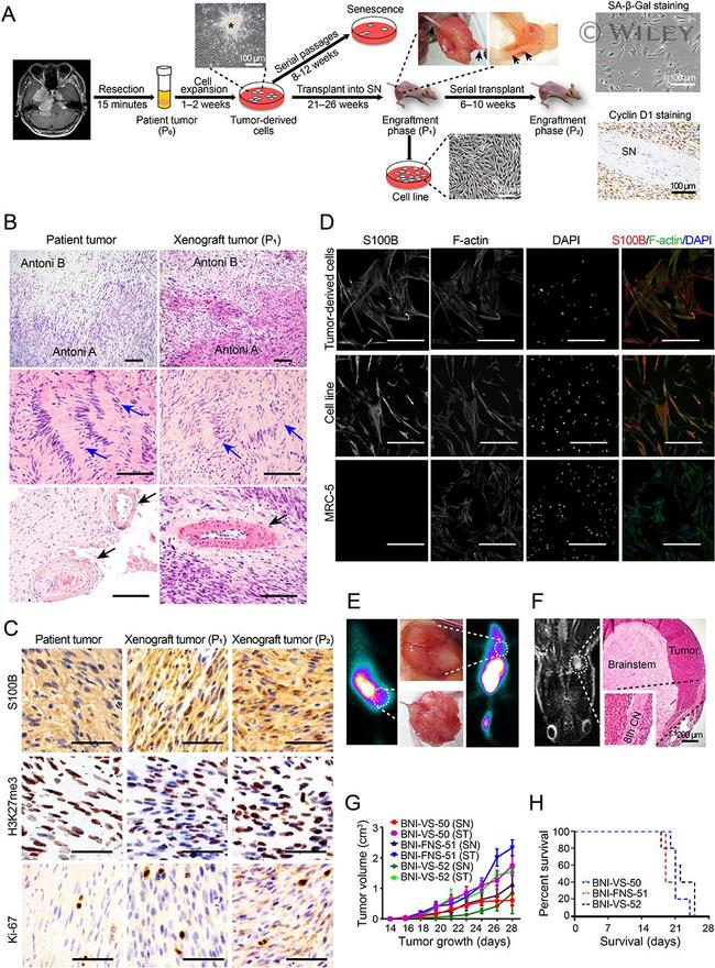 S100B Antibody in Immunocytochemistry (ICC/IF)